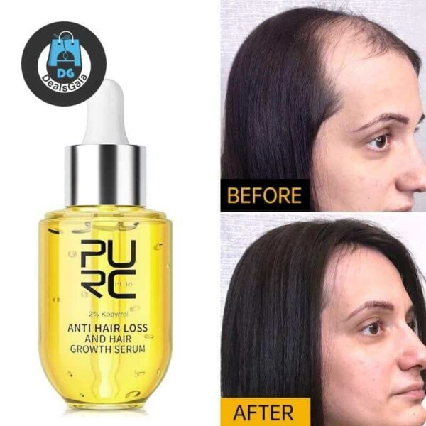 2023 PURC Fast Hair Growth for Men Women Ginger Grow Hair Oil Care Anti Hair Loss Scalp Treatment Essentials Serum Products 50ml 1ef722433d607dd9d2b8b7: Asia|France|Russian Federation|SPAIN 